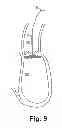 Fig. 06 - TAVR Ventricular Catheter