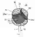 Fig. 03 - Prosthetic heart valve