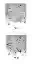 Fig. 08 - Prosthetic heart valve