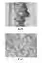 Fig. 07 - Methods for creating foam-like texture