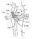 Fig. 01 - Method and apparatus for altering biomechanics of the articular joints