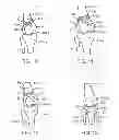 Fig. 06 - Method and apparatus for altering biomechanics of the articular joints