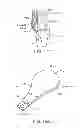 Fig. 08 - Method and apparatus for altering biomechanics of the articular joints