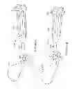 Fig. 32 - Method and apparatus for altering biomechanics of the articular joints