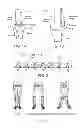 Fig. 02 - Method and apparatus for altering biomechanics of the articular joints