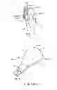 Fig. 08 - Method and apparatus for altering biomechanics of the articular joints