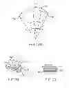 Fig. 10 - Method and apparatus for altering biomechanics of the articular joints