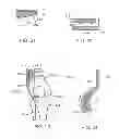 Fig. 11 - Method and apparatus for altering biomechanics of the articular joints