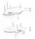 Fig. 13 - Method and apparatus for altering biomechanics of the articular joints