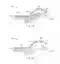 Fig. 16 - Method and apparatus for altering biomechanics of the articular joints