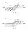 Fig. 18 - Method and apparatus for altering biomechanics of the articular joints