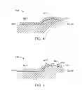 Fig. 19 - Method and apparatus for altering biomechanics of the articular joints
