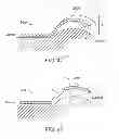 Fig. 22 - Method and apparatus for altering biomechanics of the articular joints