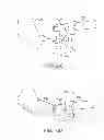 Fig. 33 - Method and apparatus for altering biomechanics of the articular joints