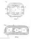 Fig. 09 - Vertebral body replacement