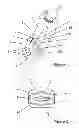 Fig. 02 - Expandable cage for the interbody fusion of lumbar vertebrae