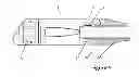 Fig. 04 - Expandable cage for the interbody fusion of lumbar vertebrae