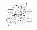 Fig. 01 - Spinal implant alignment guide systems