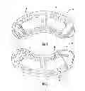 Fig. 02 - Spinal implant alignment guide systems