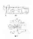 Fig. 06 - Spinal implant alignment guide systems
