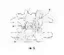 Fig. 08 - Spinal implant alignment guide systems