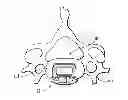 Fig. 01 - Interbody device and plate for spinal stabilization and instruments for positioning same