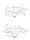 Fig. 06 - Interbody device and plate for spinal stabilization and instruments for positioning same