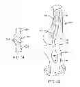 Fig. 06 - Unlinked Implantable Knee Unloading Device