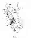 Fig. 08 - Unlinked Implantable Knee Unloading Device