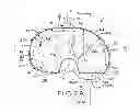 Fig. 04 - Motion facilitating tibial components for a knee prosthesis