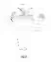 Fig. 03 - Bicruciate retaining tibial baseplate