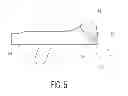 Fig. 06 - Bicruciate retaining tibial baseplate