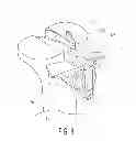 Fig. 09 - Bicruciate retaining tibial baseplate