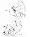 Fig. 03 - PROSTHESIS AND IMPLEMENTATION SYSTEM