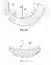 Fig. 04 - PROSTHESIS AND IMPLEMENTATION SYSTEM