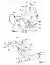 Fig. 05 - PROSTHESIS AND IMPLEMENTATION SYSTEM