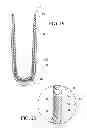 Fig. 07 - Suspension liner system with seal