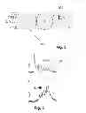 Fig. 07 - COMPUTING DEVICE, A SYSTEM AND A METHOD FOR PARALLEL PROCESSING OF DATA STREAMS