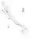 Fig. 02 - CLEANING TOOL ASSEMBLY WITH A DISPOSABLE CLEANING IMPLEMENT