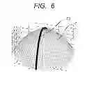 Fig. 07 - Contour shape measurement method