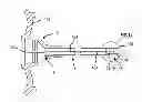 Fig. 01 - Method of manufacturing a peelable atraumatic tip and body for a catheter or sheath