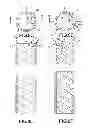 Fig. 07 - Method of manufacturing a peelable atraumatic tip and body for a catheter or sheath