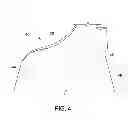 Fig. 04 - METHOD OF LOCALLY INSPECTING AND REPAIRING A COATED COMPONENT