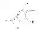 Fig. 01 - Removable Fishing Bead