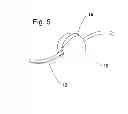 Fig. 06 - Removable Fishing Bead