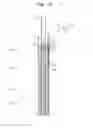 Fig. 09 - Method and sliding form for producing a structure and corresponding structure