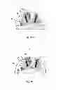 Fig. 06 - Method for arranging a printing plate on a plate cylinder