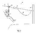 Fig. 02 - Brake and capture system for zip lining