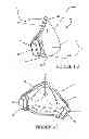Fig. 03 - Textile mask systems