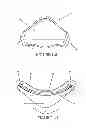 Fig. 05 - Textile mask systems